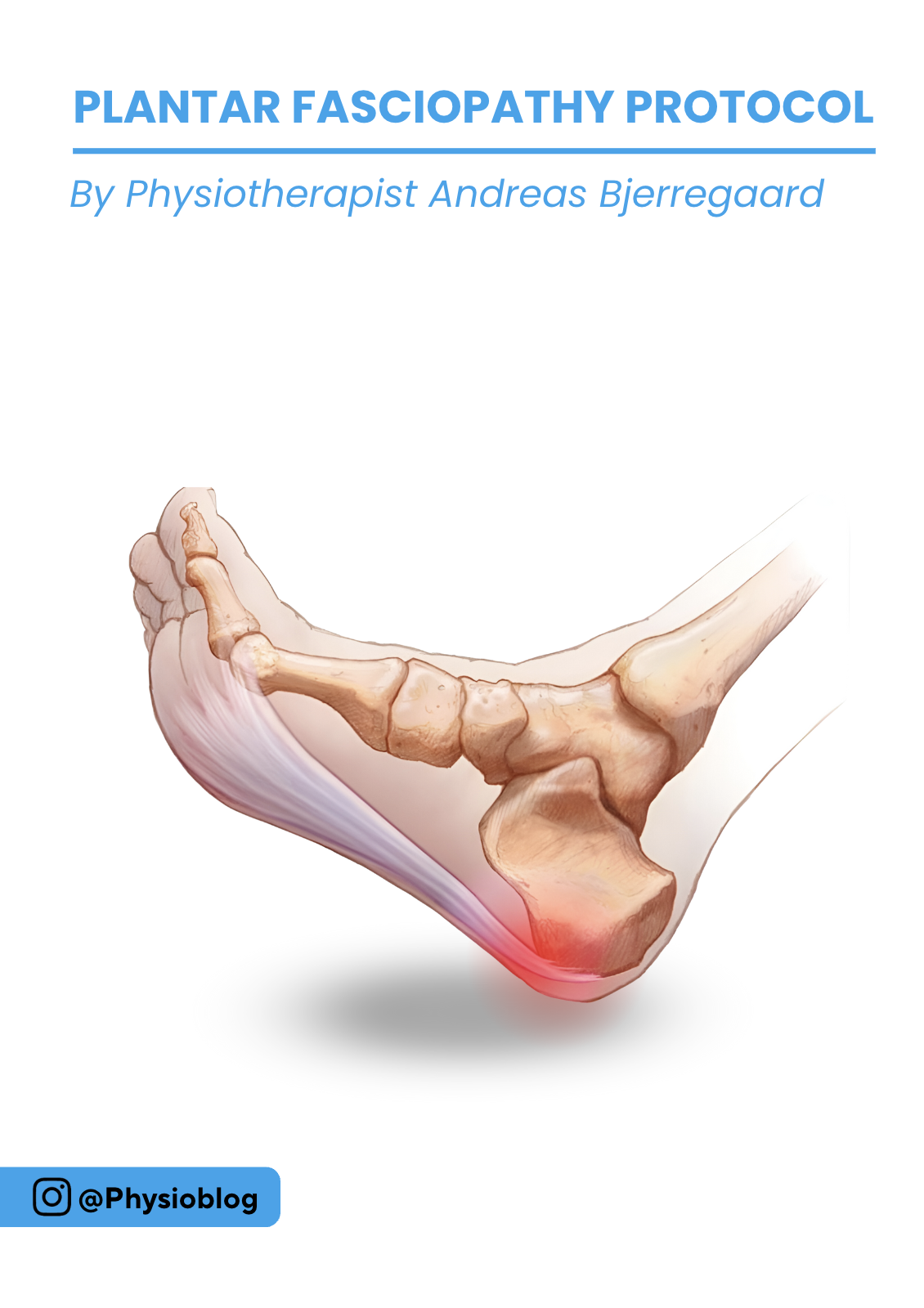 Ebook: Plantar Fasciopathy Protocol