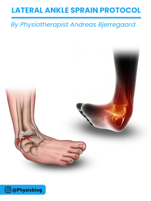 Ebook: Lateral ankle sprain