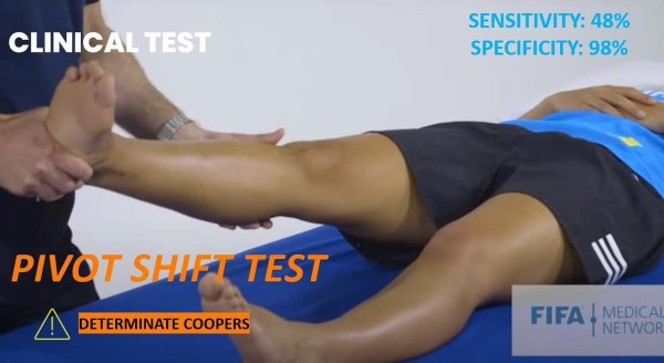 pivot shift test to detect anterolateral rotary instability ...