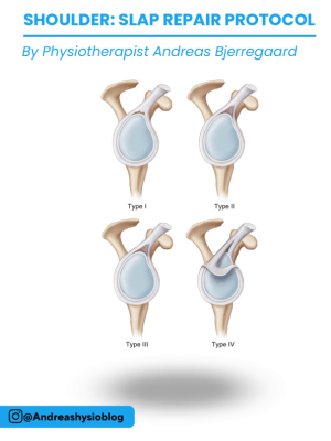 Ebook: Shoulder SLAP Repair Protocol
